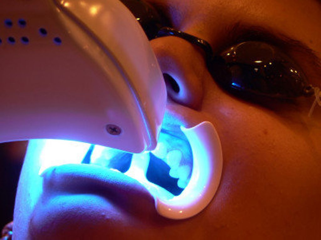 La fuente de luz empleada en su clínica dental acelera el efecto del producto blanqueante