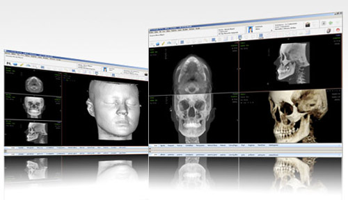 Nemoscan permite visualizar la cirugía de forma previa, asegurando una precisión total Nemoscan permite visualizar la cirugía de forma previa, asegurando una precisión total