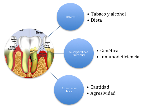 Factores predisponentes de la periodontitis Factores predisponentes de la periodontitis