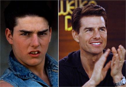 ¿Puede que el cambio en la sonrisa de Tom Cruise le ayudara en su carrera al éxito? ¿Puede que el cambio en la sonrisa de Tom Cruise le ayudara en su carrera al éxito?