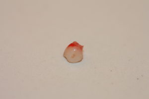 Milk pieces often fall off spontaneously when they lose their roots.