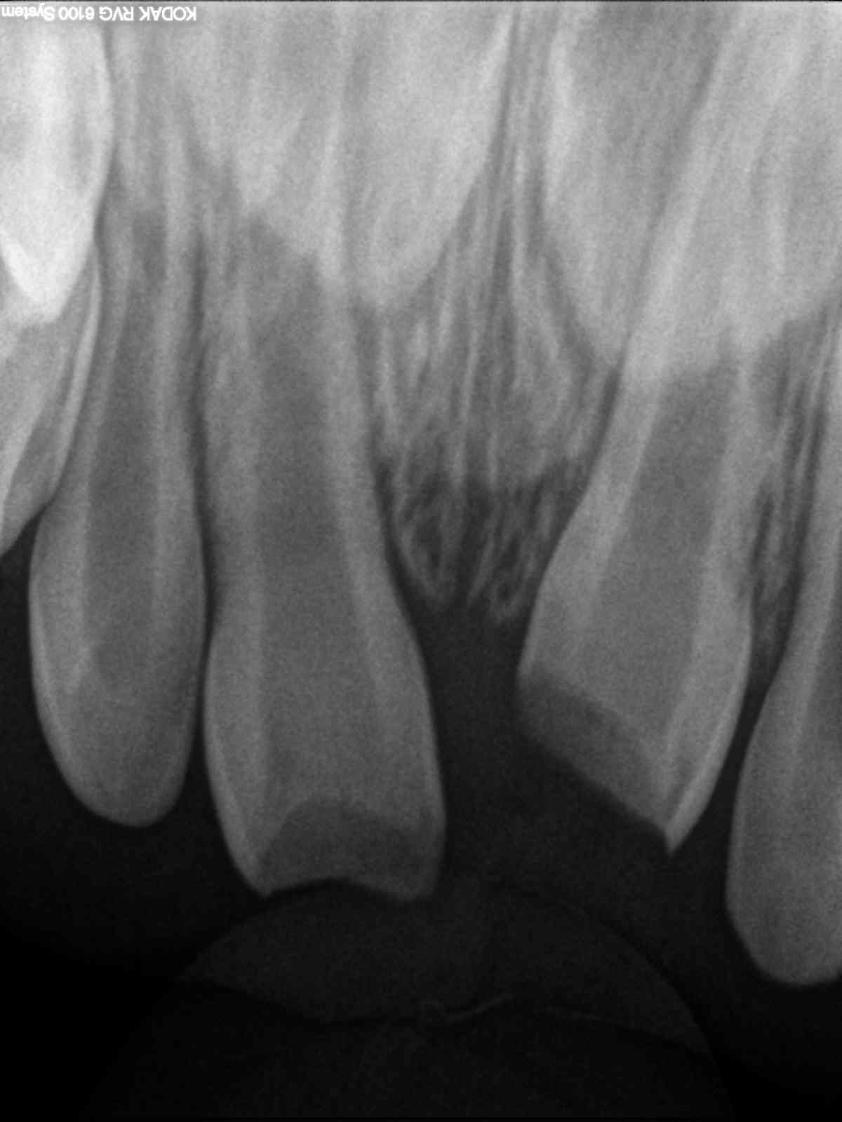 The paediatric dentist shall make a diagnosis supported by periapical radiographs.