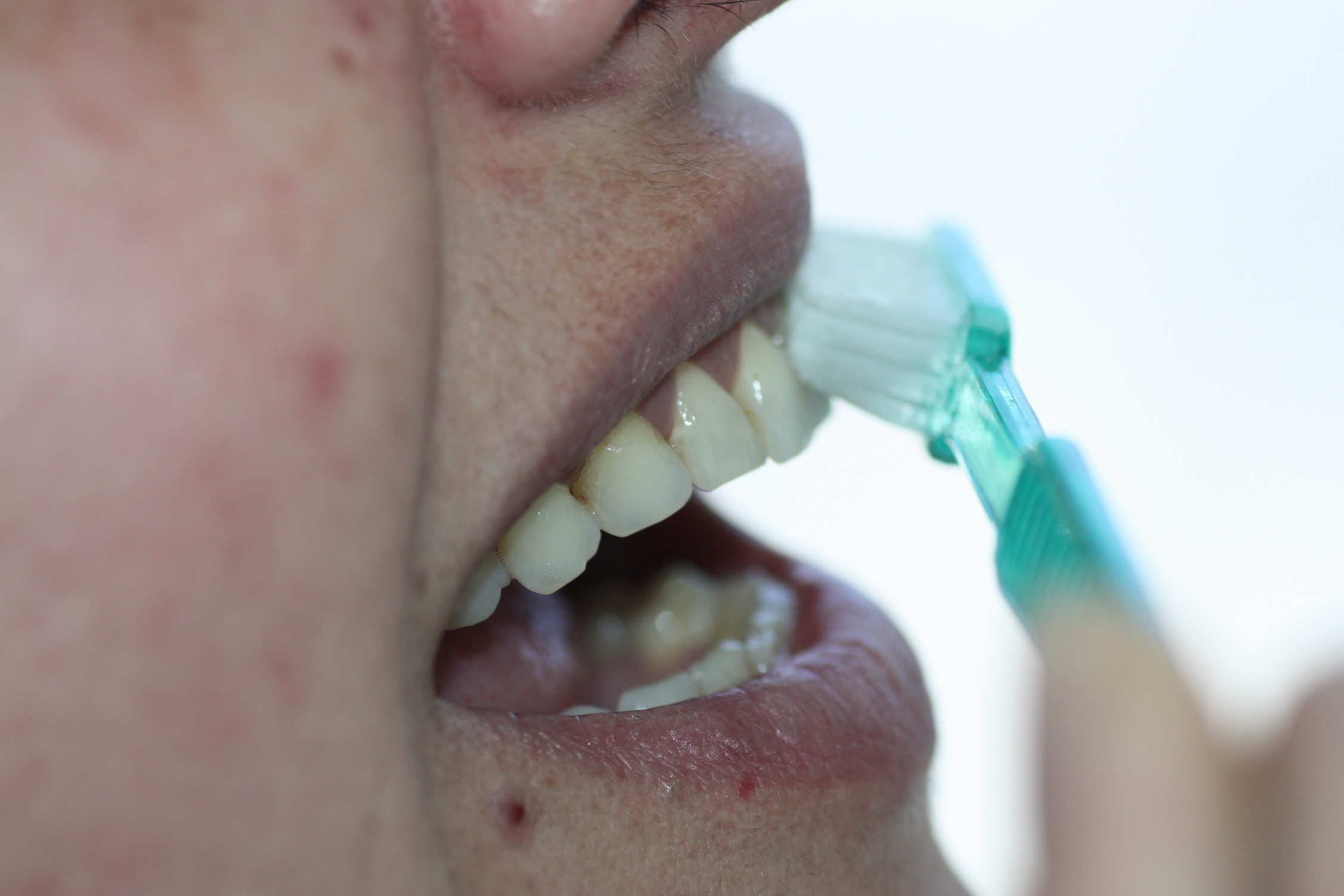 El cepillo se coloca con una inclinación de 45º sobre los dientes, haciendo movimientos desde la encía hacia el borde del diente