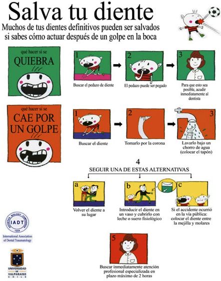 Poster designed by the International Association of Dental Traumatology on how to save a tooth