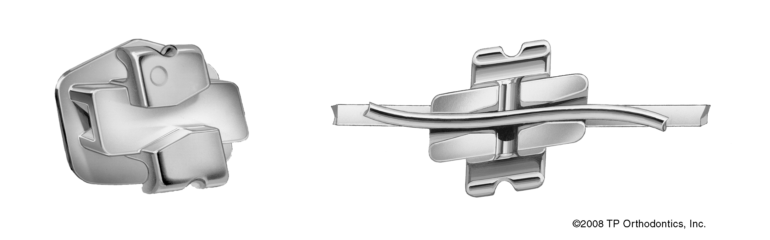 Vista posterior bracket Tip-Edge Plus