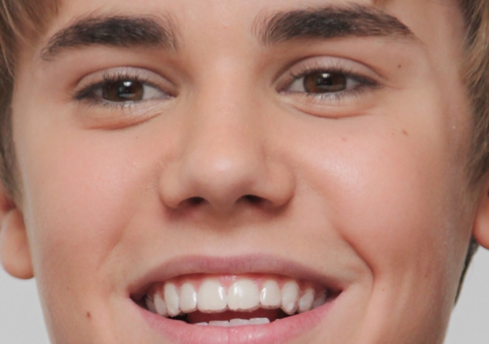 Justin Bieber y muchos adolescentes más llevan Invisalign