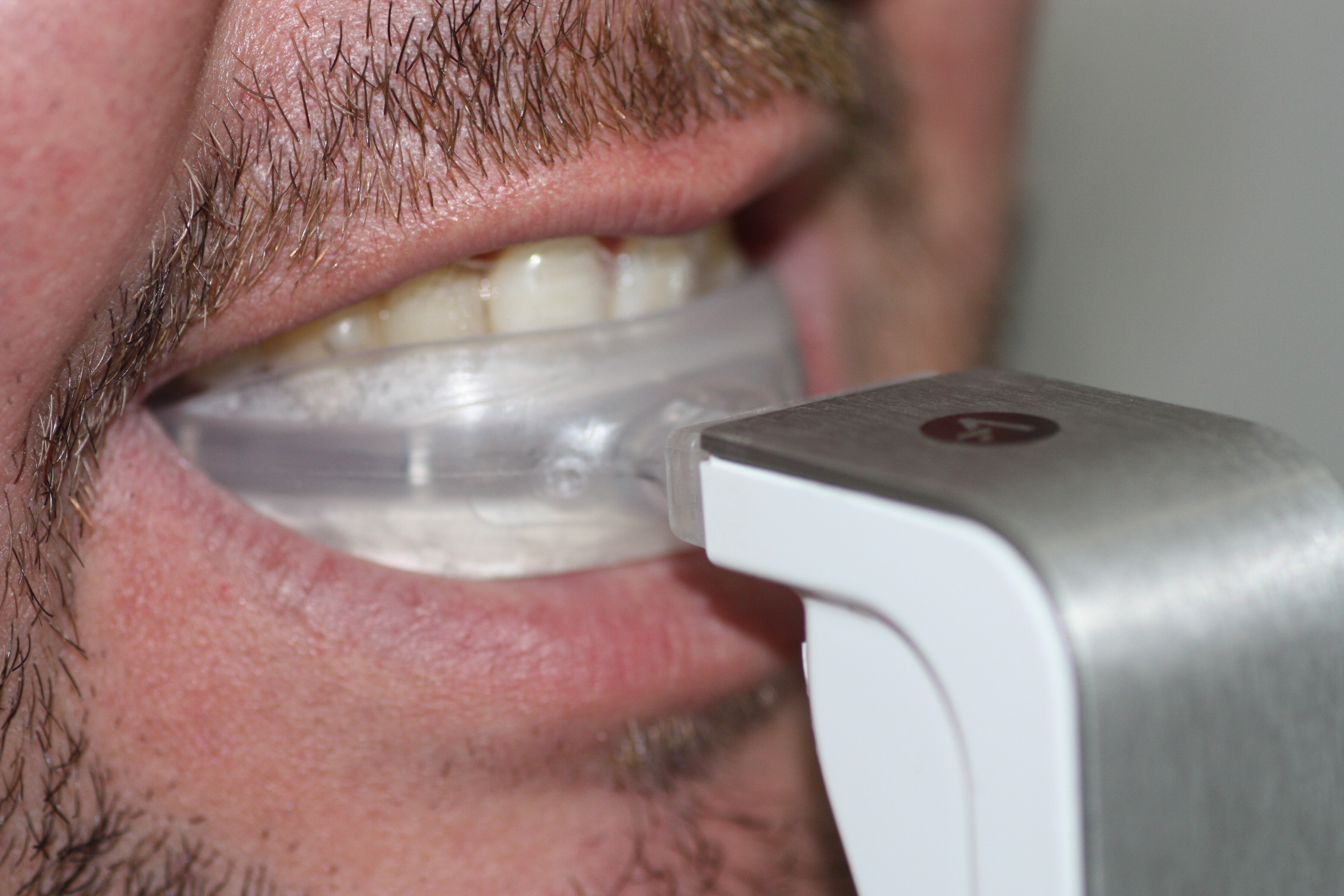 Un paciente con Invisalign y Acceledent disfruta de un tratamiento cómodo, rápido y estético