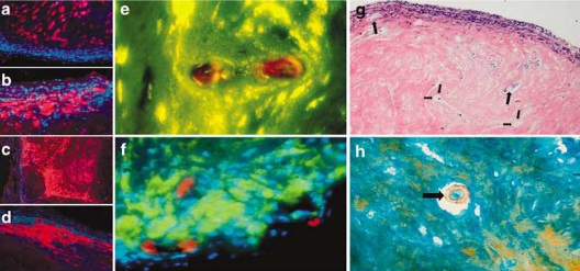 Osteogénesis y vasculogénesis inducidas a partir de células madre