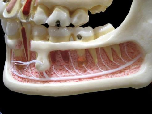 La anestesia troncular en la mandíbula suele dormir la mitad de la lengua y del labio del mismo lado de forma temporal