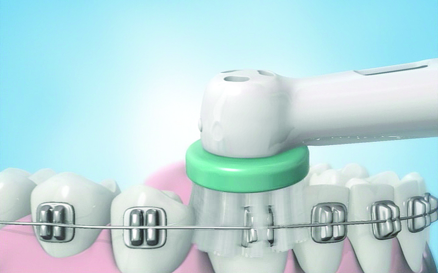 Head-Orthodontic-Brackets-Brush-Electric-Brush-Oral-B