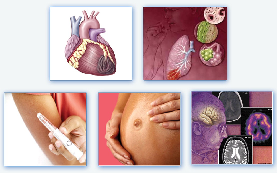 Periodontics-Arthritis-Alzheimer's disease-Diabetes-Murcia-Dentist