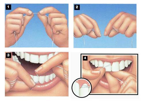 uso-hilo-dental